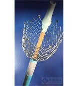 强生 Cordis 外周介入 Cordis镍钛支架系统 SMART Control Nitinol 
