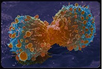 我国细胞免疫治疗肿瘤或将进入快车道