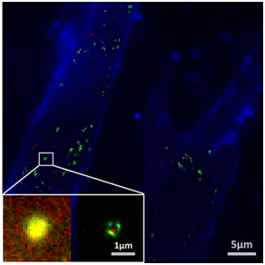 1512026495292480.png 20170928213950149.png