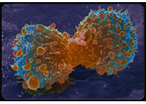 1543206234486900.jpeg lung-cancer-s12-lung-cancer-cell-division.jpg